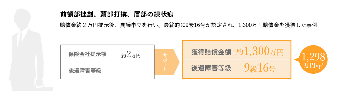 前額部挫創、頭部打撲、眉部の線状痕 賠償金約2万円提示後、異議申立を行い、最終的に9級16号が認定され、1,300万円賠償金を獲得した事例 保険会社提示額約2万円 後遺障害等級なし サポート後：獲得賠償金額約1,300万円 後遺障害等級9級16号 1,298万円up！