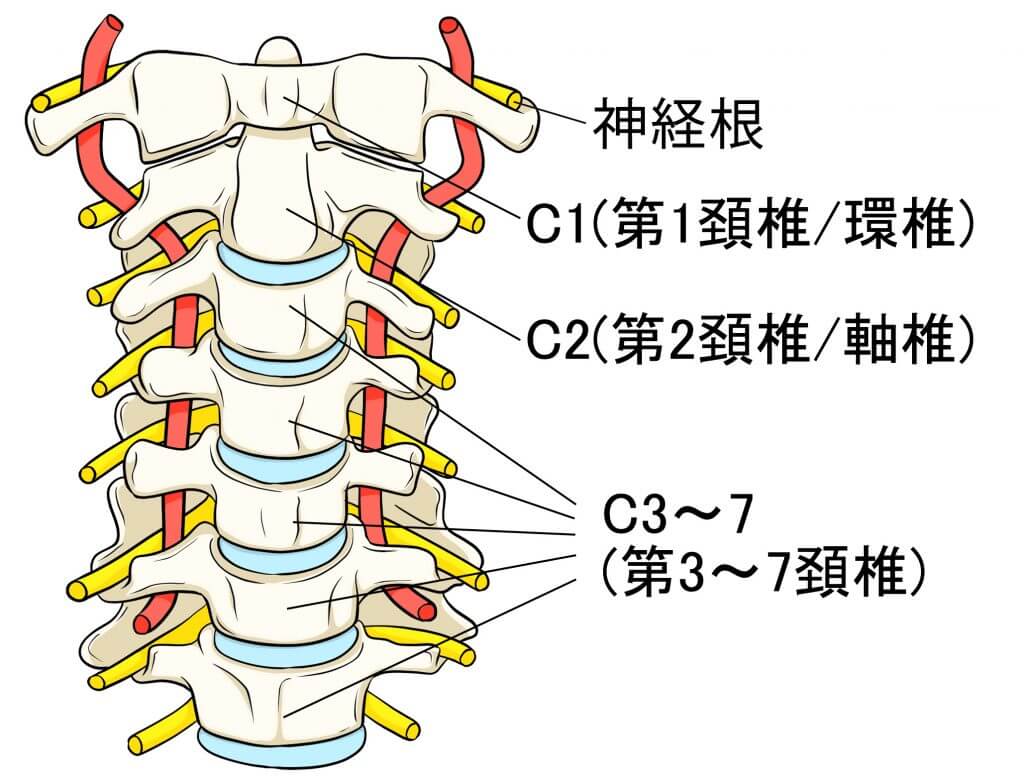 神経根症型