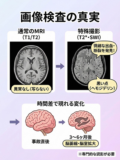 画像検査の真実：通常のMRIと特殊撮影の違い